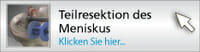 Teilresektion Meniskus
